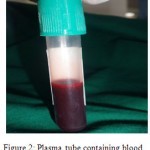 Figure 2: Plasma tube containing blood