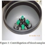 Figure 3: Centrifugation of blood samples