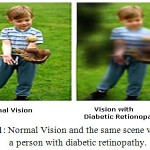 Figure 1: Normal Vision and the same scene viewed by a person with diabetic retinopathy.