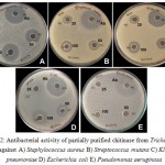 Figure 2: Antibacterial activity of partially purified chitinase from Trichoderma viride against A) Staphylococcus aureus B) Streptococcus mutans C) Klebsiella pneumoniae D) Escherichia coli E) Pseudomonas aeruginosa