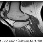Figure 1: MR Image of a Human Knee Joint