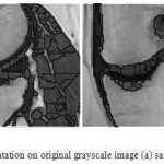Figure 10: Watershed segmentation on original grayscale image (a) sagittal plane (b) coronal plane