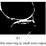 Figure 11: Binary image of sagittal plane after removing (a) small noisy regions (b) Large noisy regions (c) all the noise