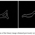 Figure 13: Canny edge detection of the binary image obtained previously (a) sagittal plane (b) coronal plane