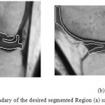 Figure 14: Outlining the boundary of the desired segmented Region (a) sagittal plane (b) coronal plane