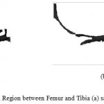 Figure 15: Desired segmented Region between Femur and Tibia (a) sagittal plane (b) coronal plane