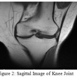 Figure 2: Sagittal Image of Knee Joint