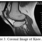 Figure 3: Coronal Image of Knee Joint