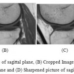 Figure 5a: Noise sifted picture of sagittal plane, (B) Cropped Image of sagittal plane, (c) Resize of edited picture 1.5 times in sagittal plane and (D) Sharpened picture of sagittal plane