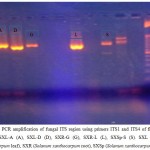 Figure 2: PCR amplification of fungal ITS region using primers ITS1 and ITS4 of five fungal strains; SXL-A (A), SXL-D (D), SXR-G (G), SXR-L (L), SXSp-S (S). SXL (Solanum xanthocarpum leaf), SXR (Solanum xanthocarpum root), SXSp (Solanum xanthocarpum spines).