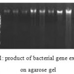 Figure 1: product of bacterial gene extraction on agarose gel