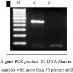 Figure 2: rsbA gene PCR product. M: DNA Marker. 1: rsbA gene PCR product in samples with more than 50 percent antibiotic resistance. 2: rsbA gene PCR product in samples with less than 50 percent antibiotic resistance