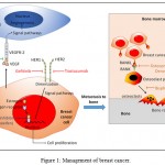 Figure 1: Management of breast cancer.