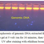 Figure 1: Gel electrophoresis of genomic DNA extracted from blood samples. 1% agarose gel at 5 volt /cm for 30 minutes, then visualized under UV after staining with ethidium bromide.