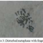 Figure 3: Disturbed metaphase with fragments