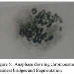 Figure 5: Anaphase showing chromosome fussiness bridges and fragmentation