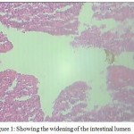 Figure 1: Showing the widening of the intestinal lumen