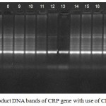 Figure 1: Detection of PCR product DNA bands of CRP gene with use of CRP1F CRP1R primers (238 bp.).