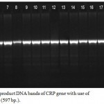 Figure 2: Detection of PCR product DNA bands of CRP gene with use of CRP2F and CRP2R primers (597 bp.).