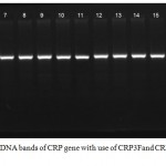 Figure 3: Detection of PCR product DNA bands of CRP gene with use of CRP3Fand CRP3R primers (485 bp.).