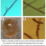 Figure 2: Hyphae of Rhizoctonia solani showing multinucleate (A), Hyphae with right-angled branching pattern and septa (B), Mycelia and sclerotia formed on PDA (C) and barrel-shaped moniliod cells in chain, 14 days at 28°C on PDA (D).