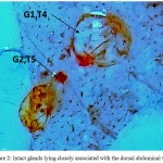 Figure 2: Intact glands lying closely associated with the dorsal abdominal wall.