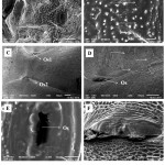 Figure 4: SEM images of the ostioles in nymphs (A, B and E) and adults (C, D and F), the structural variability can be compared in terms of ostiole (Os) opening (E and F) in nymphs and adults respectively and the structure of cells surrounding it.
