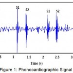 Figure 1: Phonocardiographic Signal