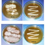 Figure 3: Culture plates of top seven high yielding isolates positive for succinic acid production