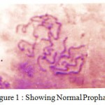 Figure 1: Showing Normal Prophase
