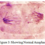 Figure 3: Showing Normal Anaphase