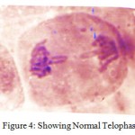 Figure 4: Showing Normal Telophase