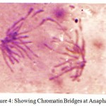 Figure 4: Showing Chromatin Bridges at Anaphase