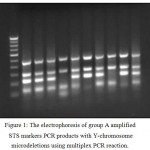 Figure 1: The electrophoresis of group A amplified STS markers PCR products with Y-chromosome microdeletions using multiplex PCR reaction.