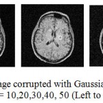 Figure 1.2: Input MRI image corrupted with Gaussian Noise at standard deviation σ = 10,20,30,40, 50 (Left to Right).