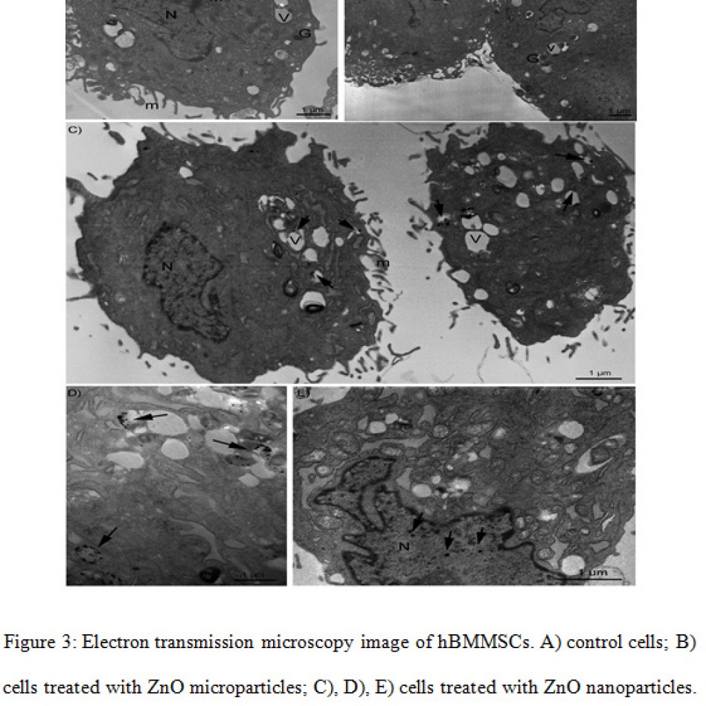 Effect of ZnO Nanoparticles on Human Bone Marrow Mesenchymal Stem Cells ...