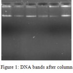 Figure 1: DNA bands after column purification.