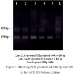 Figure 3: Showing PCR products of 490 bp and 190 bp for ACE I/D Polymorphism.
