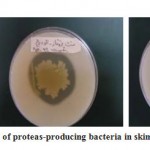 Figure 1: Some samples of proteas-producing bacteria in skimmed milk agar plates