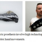 Figure 10: Myoelectric prosthesis involve high technology and enables composite and complex hand movements.