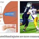 Figure 8: Sports related Hand injuries are more common with contact sports.