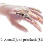 Figure 9: A small joint prosthesis (Silicone).