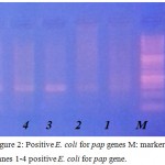 Figure 2: Positive E. coli for pap genes M: marker Lanes 1-4 positive E. coli for pap gene.