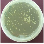 Figure 3: Agrobacterium tumefaciens-meditaed transformation with ChiC gene of potato ‘Diamant’.