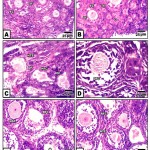 Figure 1: (A-F). Photomicrographs of histological sections of ovary of neonate 2 week-old.