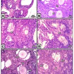 Figure 2: (A-F). Photomicrographs of histological sections of ovary of neonate 3 week-old.