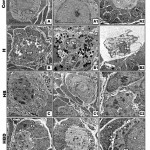 Figure 3: (A-D2). Transmission electron micrographs of ovary of 3week-old rat.