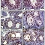 Figure 4: (A-F). Photomicrographs of formalin-fixed, paraffin-embedded ovary of 3 week old neonate immunohistochemically stained with the antibody of PCNA.