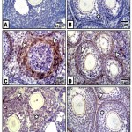 Figure 6: (A-F). Photomicrographs of formalin-fixed, paraffin-embedded ovary of 3 week old neonate immunohistochemically stained with the antibody of caspase 3.