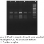 Figure 2: Positive samples for tetK gene as detected by multiplex PCR. M: Molecular marker, 1-5: Positive samples.